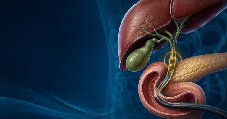 পিত্তনালির পাথরের চিকিৎসা ও ERCP